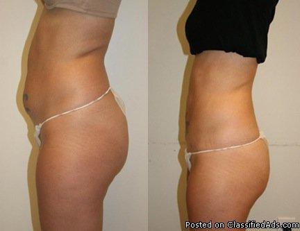 Inch Loss Wraps...Start Losing Iches Off Your Tummy Today - Price: $30.00